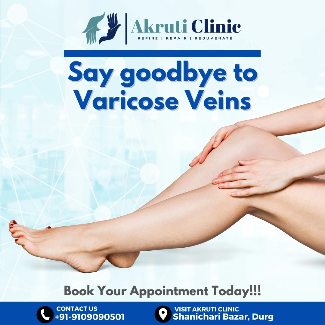 Varicose veins Treatment in Bilaspur Chhattisgarh